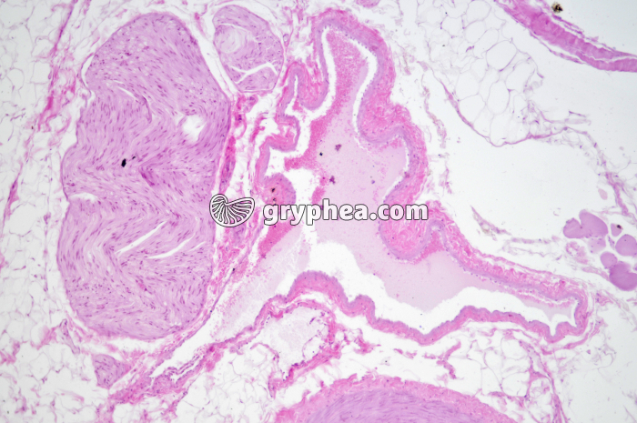 Veine CT x25 - gryphea.org